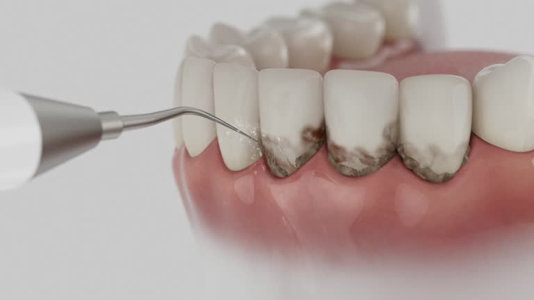 Reliable Dental Implants contractor in Upper Lake, CA by Smile Center Dentistry